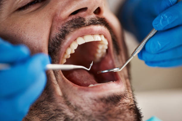 Emergency Dental Services in Greenback, TN